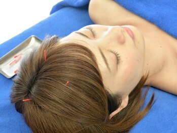 オレンジ鍼灸整体院の写真/【癒しの新定番！鍼灸ヘッドスパ】小顔＆肩こり改善☆癒しと美容を同時に叶える贅沢ケア♪