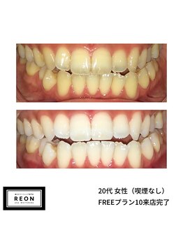 レオン 磐田(REON)/◇ お客様 before＆after ◇