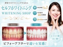 ホワイトニングショップ 津店の雰囲気（津市症例数No.１/市内最長４０分照射/20:00まで営業で通いやすい）