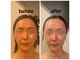 ディグニータココ 自由が丘(DIGNITA coco)の写真