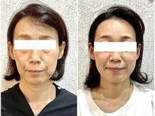 美容整体ウェリナ あま甚目寺院の雰囲気（高技術！ブログに小顔矯正比較写真が載ってますのでご覧ください）