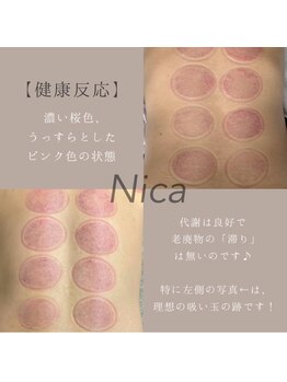 ニカ(Nica)/【健康反応】