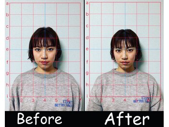 リリーフ(Re:lief)/小顔矯正のお客様の変化