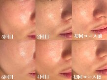 タマンサリ(Taman Sari)の雰囲気（毛穴大洗浄×ララピールで肌質改善！）