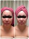 プティ ニド(Petit Nid)の写真/【1度で変化！本気の小顔ケア】むくみ・滞りを改善→パーツをあるべき所へ戻せばこんなに見違える印象に☆