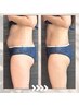 お悩み【ヘコまないぽっこり下腹/3段腹に】　￥6600→￥5280/ダイエット