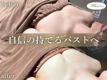 ロココ 新宿店(Rococo)の写真/一人一人に合わせたオーダーメイドの劇的バストアップ◇どんなお胸もお任せあれ!!ふっくらマシュマロ胸に♪