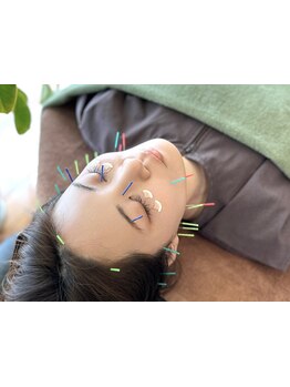 鍼灸施術を受けたい