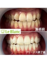 ルブラン 奈良店(Le Blanc)/全体的にトーンアップ！