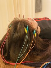 ジェイペック鍼灸整骨院/頭皮バリ