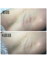 エヌアール(NR)/ladies　脇