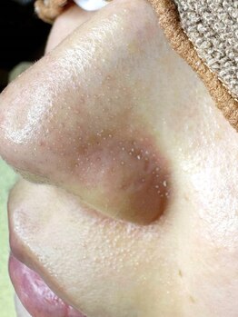 ルージュプラスエックス(ROUGE+X)の写真/【毛穴悩みがある方に】丁寧なカウンセリングとハンドテクニックにこだわり、あなたのキレイをサポート◎