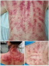 長寿堂 東洋整体院/全身カッサ+整体矯正