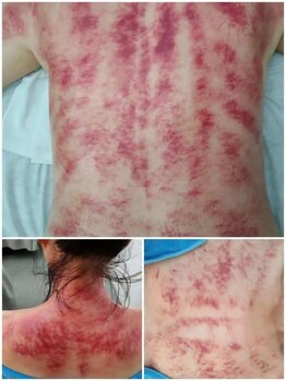 長寿堂 東洋整体院/全身カッサ+整体矯正