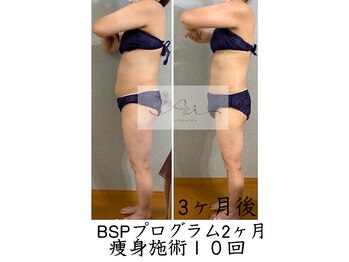 アイ エステサロン(Ai)/【50代】健康のために痩せました