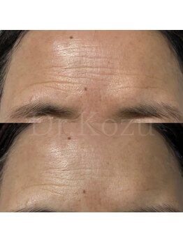 アルルプラス 山科(ARuru+)/【ヴァンパイアマスク】