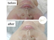 グレイス(Grace)/ララピール