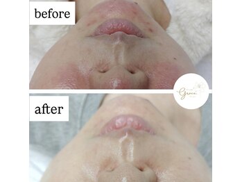 グレイス(Grace)/ララピール