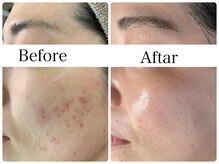 リラビューティー(Lilas Beauty)/素顔に自信を持てます！