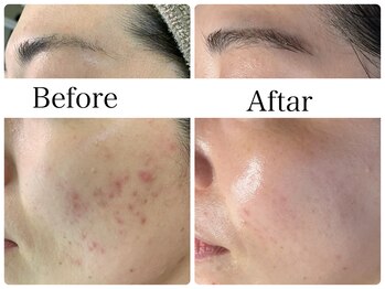 リラビューティー(Lilas Beauty)/素顔に自信を持てます!