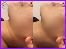 ヴィオール 名古屋栄店(VIOR)/キュっと引き締まった美ラインへ