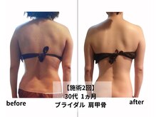 プラスイー(+e)の雰囲気（長年行方不明だった肩甲骨が皆さん！発掘できています♪）
