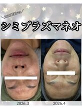 リラックスアンドビューティ(Relax&Beauty)/本気でシミ改善