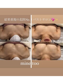 マイントゥー(mine too)/しっかり美乳へ★