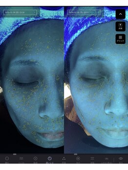 ジャスミン(Jasmin)/肌質診断機BA