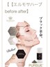 【ハーブピーリング】エルモサマグマハーブ！世界特許NMN配合
