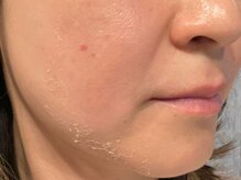 ディアナ 代々木上原(_Diana)/グリーンピール/Diana代々木上原