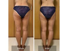 ルリアンデュレ(le lien durer)/下半身集中施術！1回目の施術後