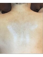 リベル 名古屋(Lebelle:)/ハーブピーリング専門　名古屋