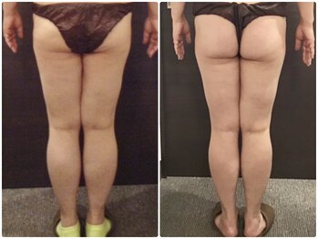 美容整体ウェリナ 名駅院/小顔矯正/骨盤矯正/美脚サロン