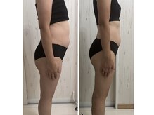 アン ヘアー アンド メイク(an hair&make)の雰囲気（筋膜リリース　血流改善　食事制限なし2か月後）