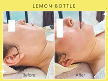 シロカネ イオンタウン西熊本店(SHIROKANE)/レモンボトル☆