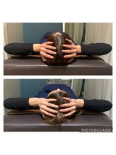 ア ムーン ドロップ(a Moon Drop)/施術前後の頭まわり