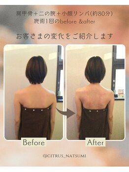 エステティックシトラス(esthetic CITRUS)/before & after
