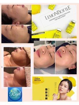 リゲル ザ ベスト(RIGEL the best)の写真/今話題の韓国最新脂肪分解「レモンボトル」で理想の小顔へ♪【小顔レモンボトルご新規様￥8900】