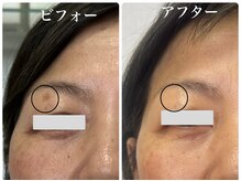 ピュア(pure)の雰囲気（シミが消えた！女子会で1番ツヤツヤ◎毎日メイクが楽しい！）