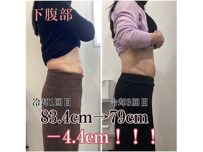 アモ(amo)の写真