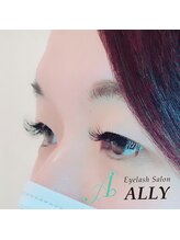 アリー(ALLY)/