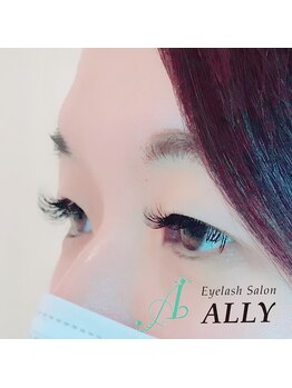 アリー(ALLY)/