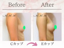 エムエムエム 表参道Luxeサロン(M.M.M)/【バストアップ例】　C→Eカップ