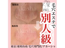 ビューティーサロン アカシャ(beauty salon Akasha)の雰囲気（一回でトーンも爆上がり！！）