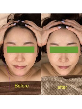 ベッピン(Beppin)/小顔ケア/頭蓋骨ケア/静岡市葵区