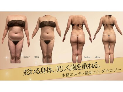 ビューティーマックス エースタジオ(Beauty MAX Astudio)の写真