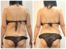 ウェリナ平和堂長久手院/小顔矯正/骨盤矯正/痩身/整体