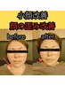 水曜日限定★極上のマッサージ/小顔調整＋骨格調整70分¥8,580