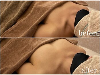 ルナリア ルクス 志木南口駅前店/即日ふっくらバストに♪